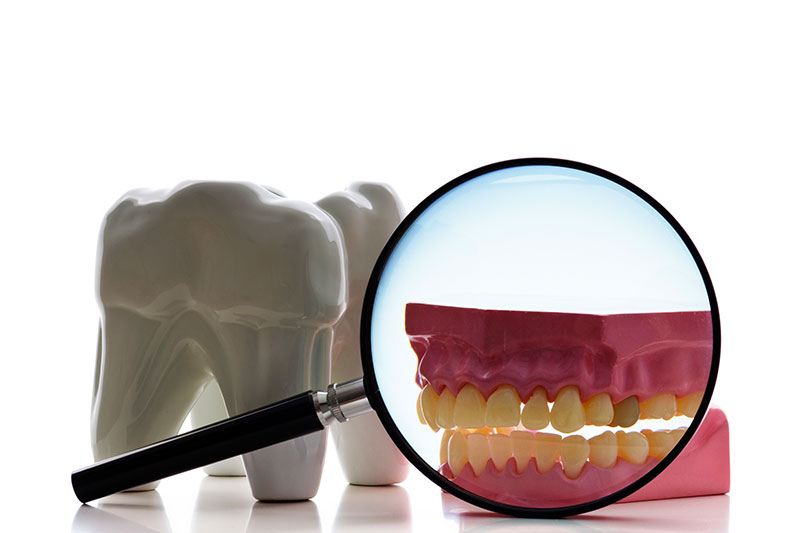 Dental Treatments in San Bernardino